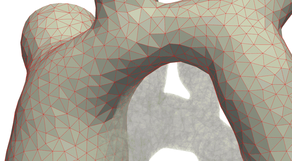 Shape-informed graph neural networks and data assimilation: application to velocity and pressure reconstruction in aortic blood flow